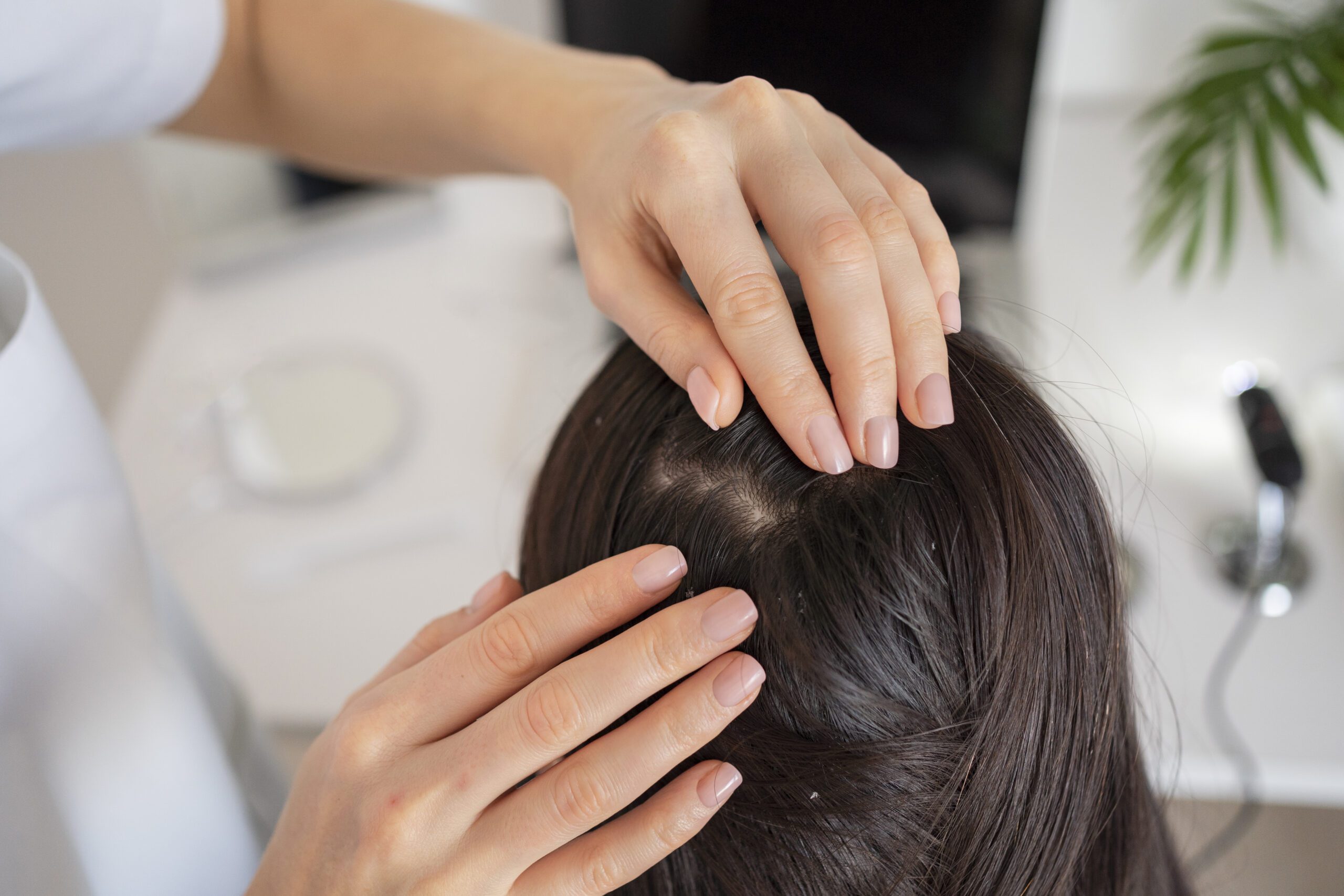 Effective natural remedies to relieve dry scalp